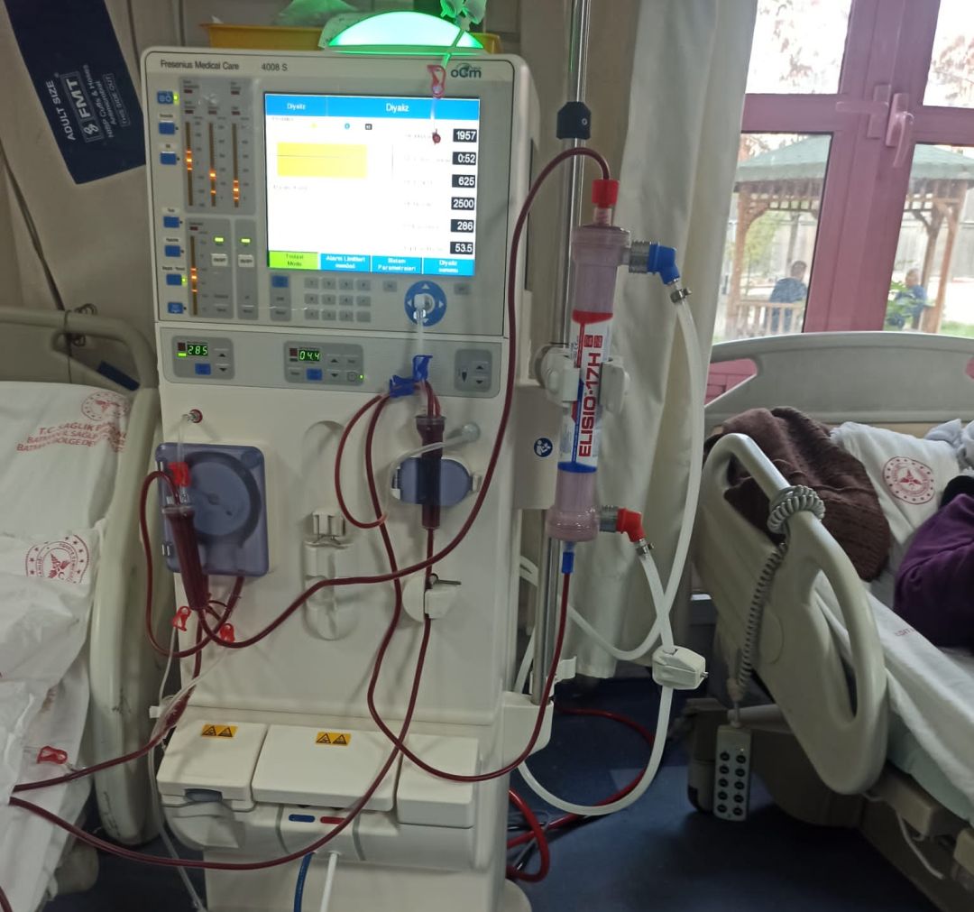 Hemodiyaliz cihazını bağışladı