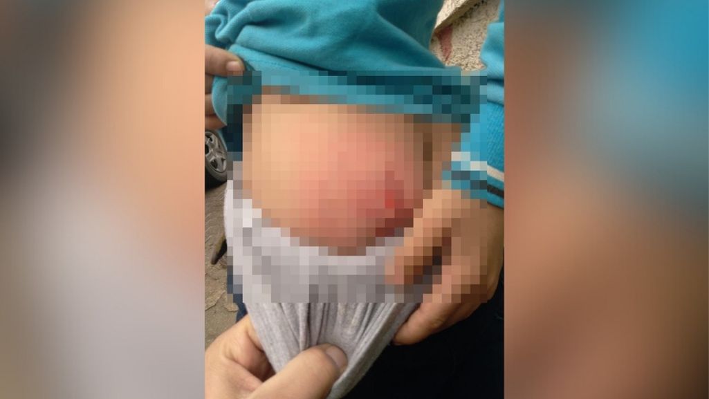 Köpeklerin saldırısına uğradı