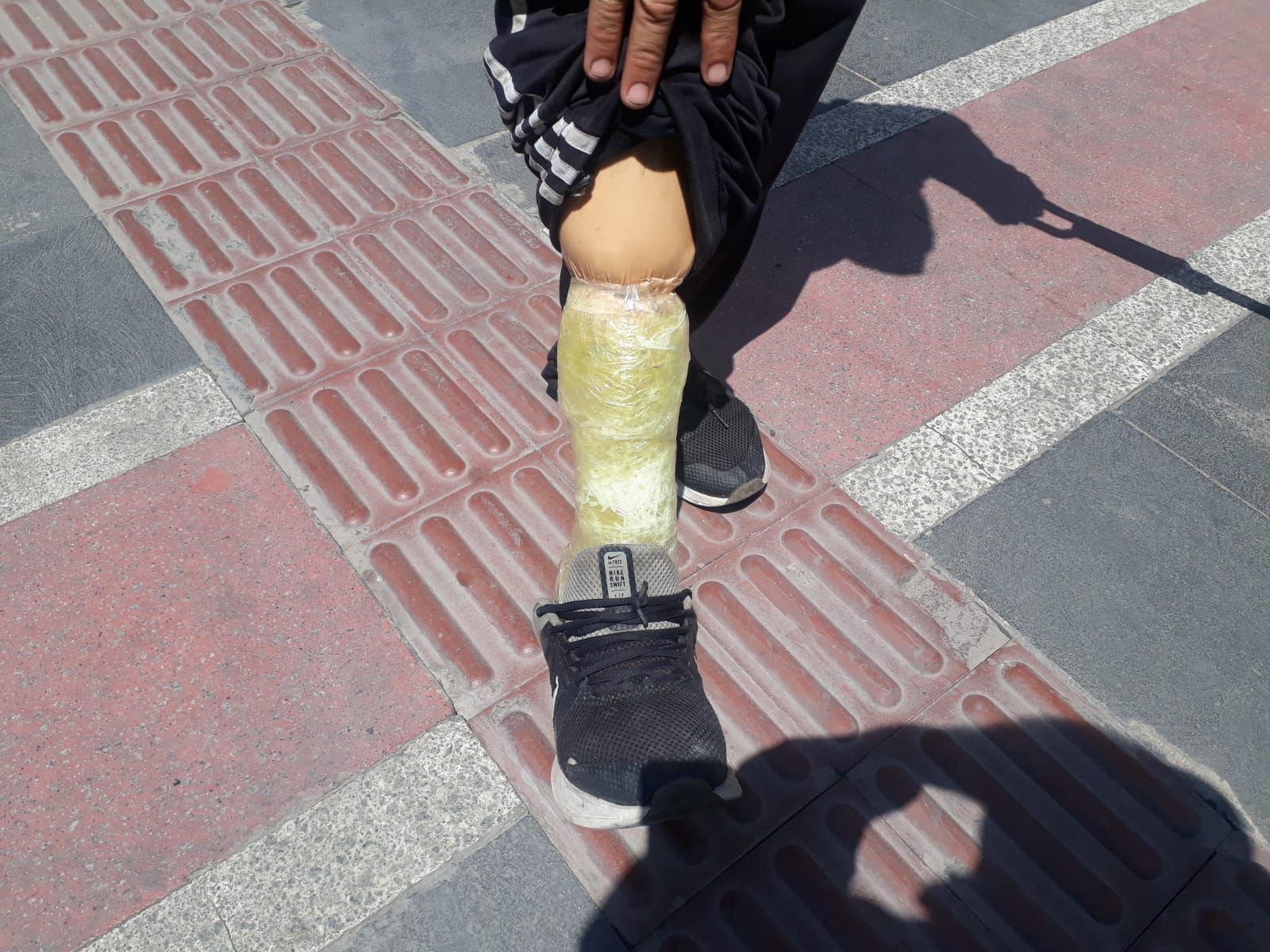 Engelli vatandaş, elektrikli motosiklet istiyor