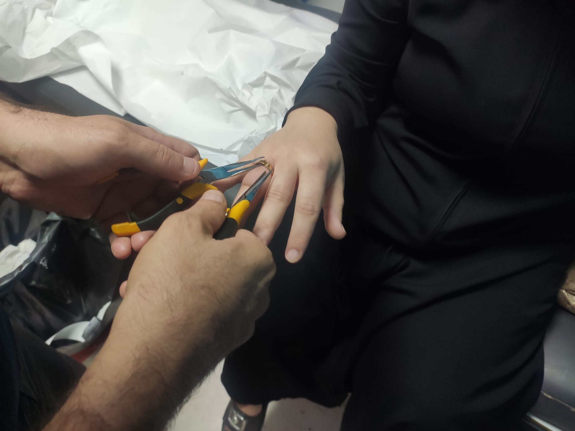 Sıkışan yüzük hastanede çıkarıldı