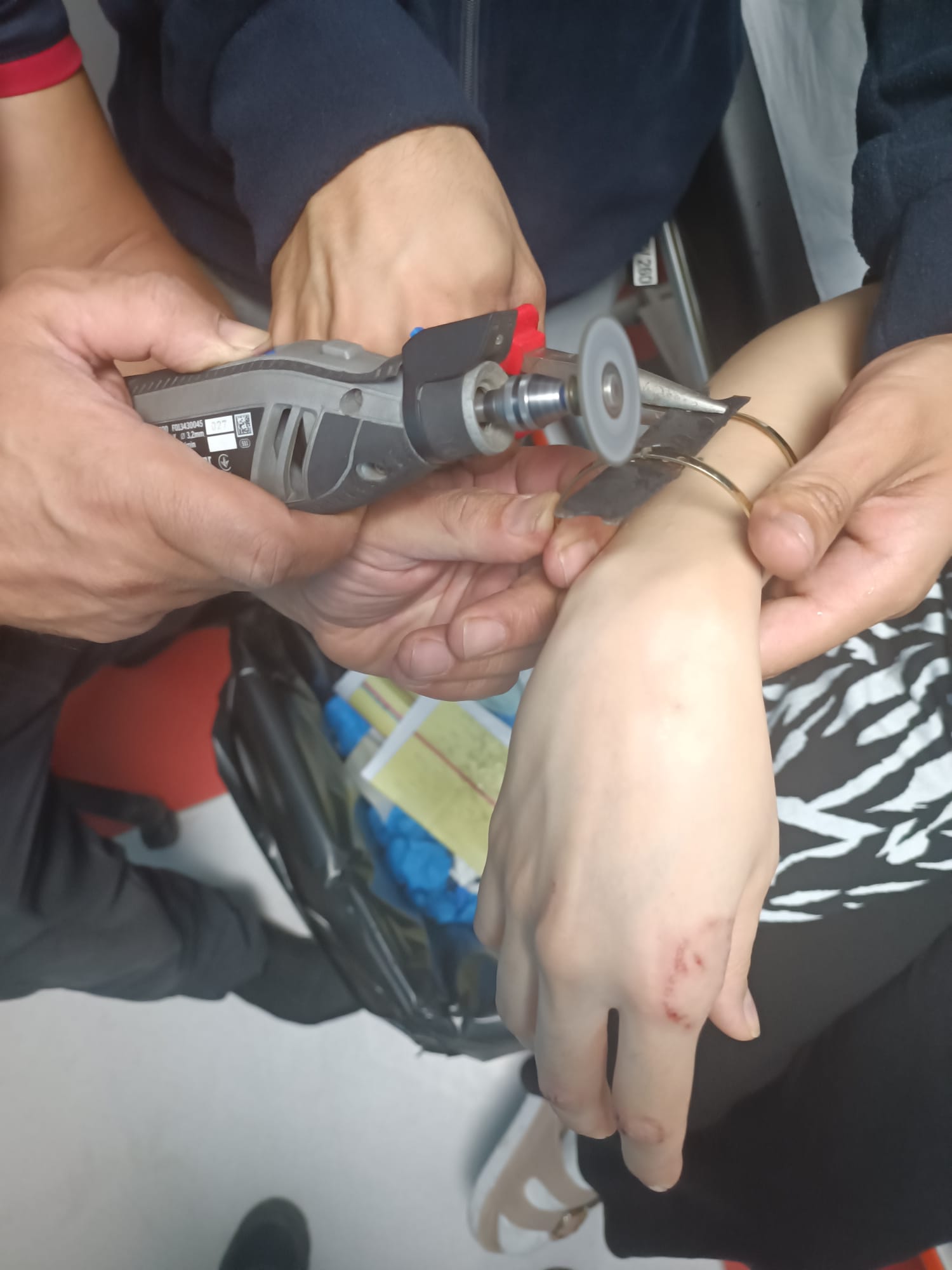 Eline sıkışan bilezik hastanede çıkarıldı