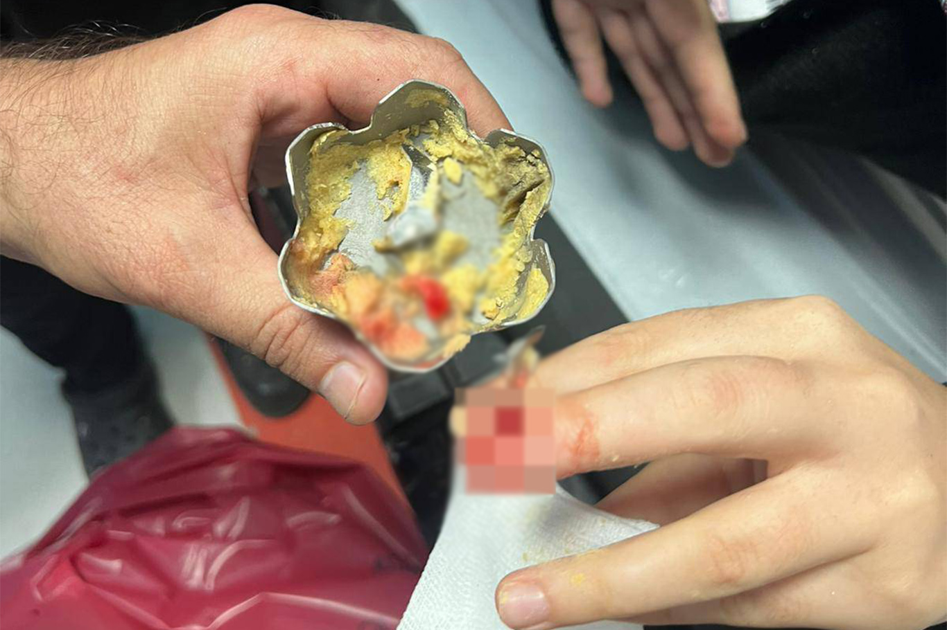 Parmağı blendere sıkıştı