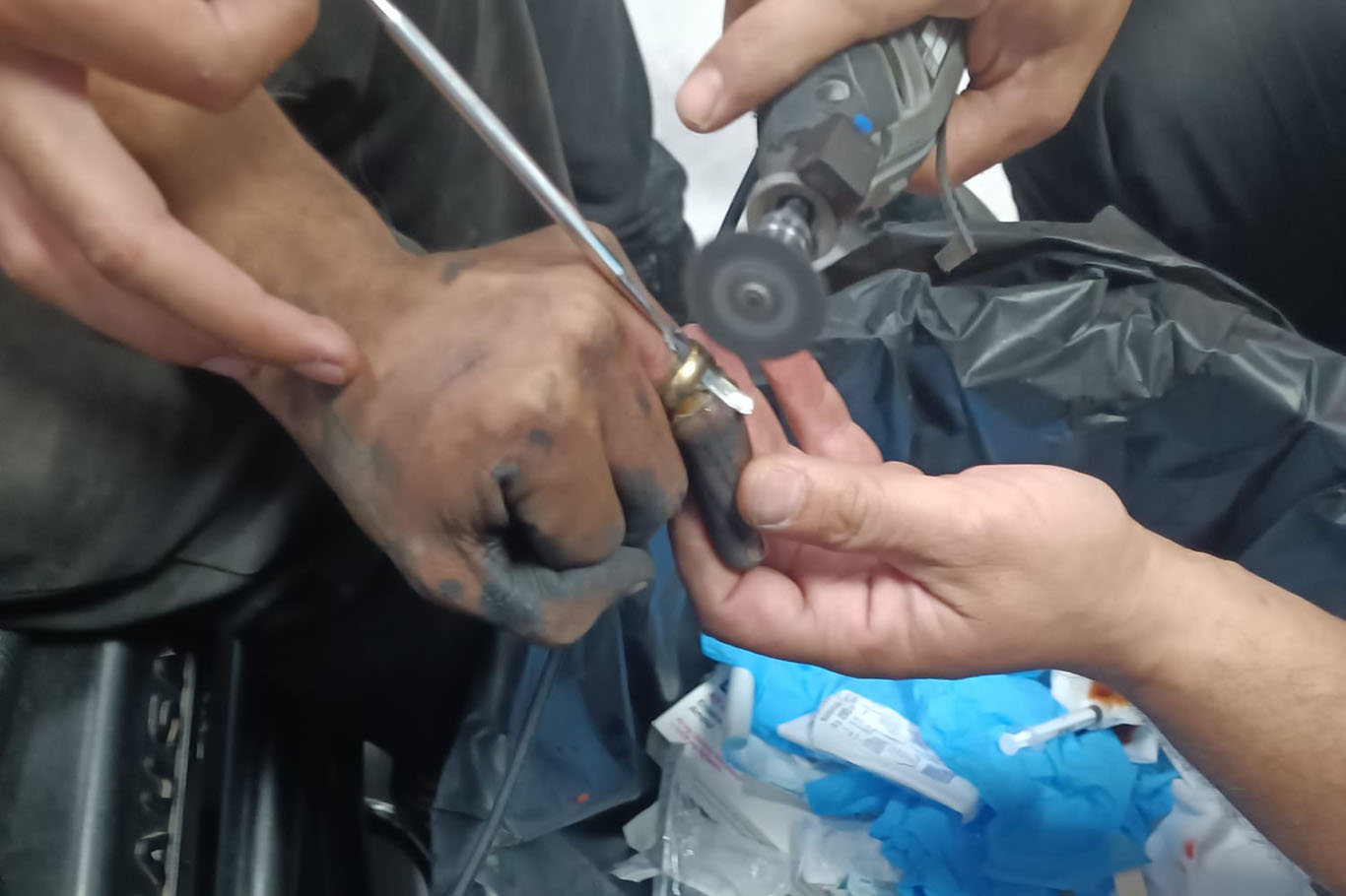 Parmağında sıkışan yüzük çıkarıldı