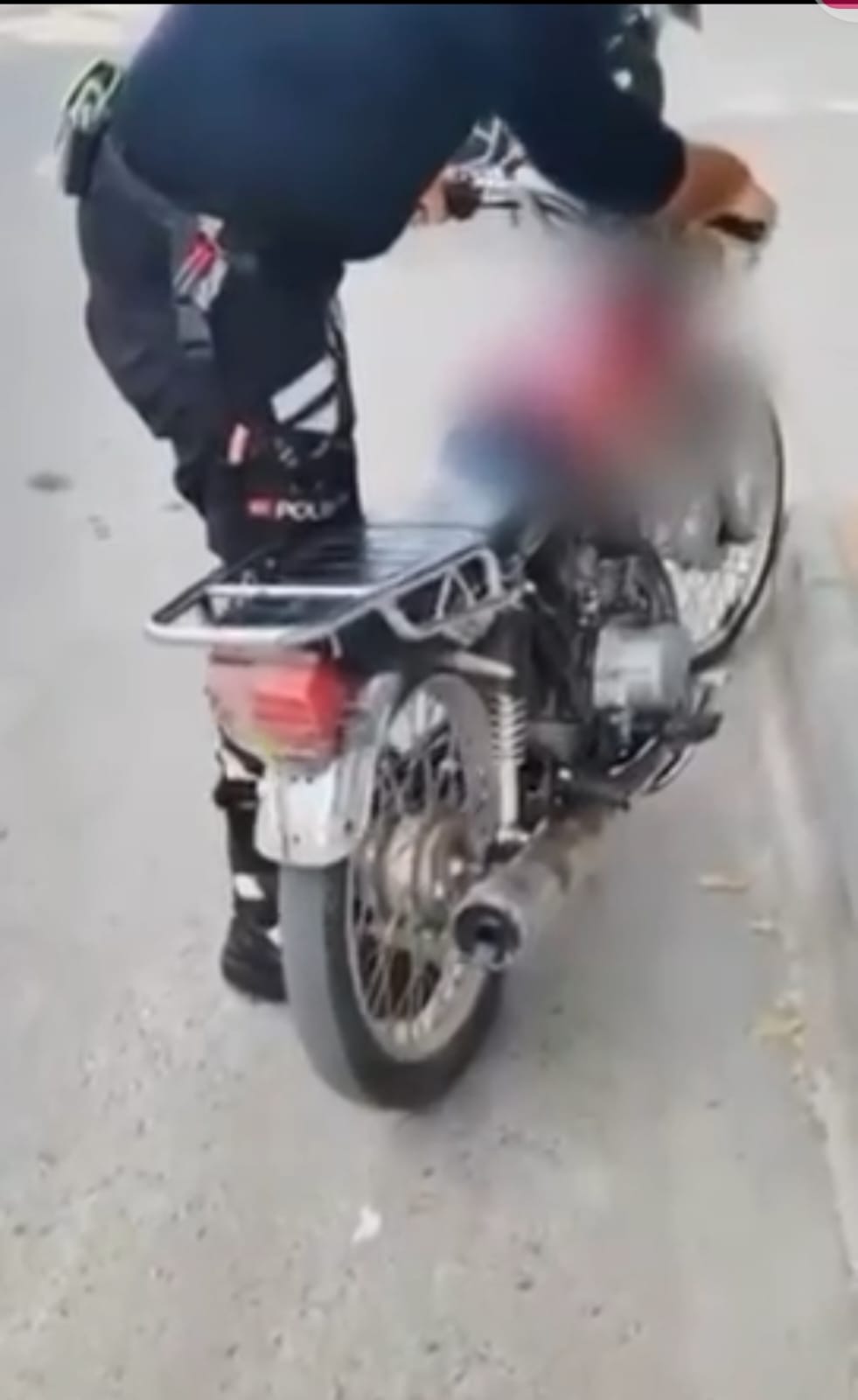 Abartı egzoz operasyonu